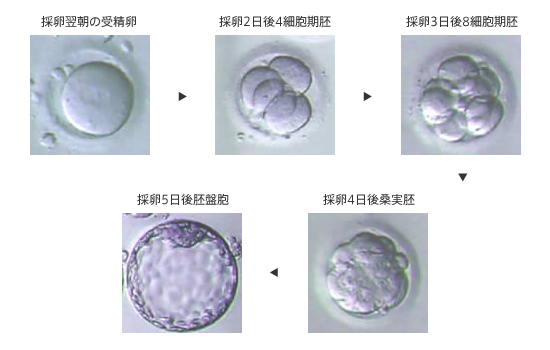 ES細胞－－発生初期の受精卵の細胞